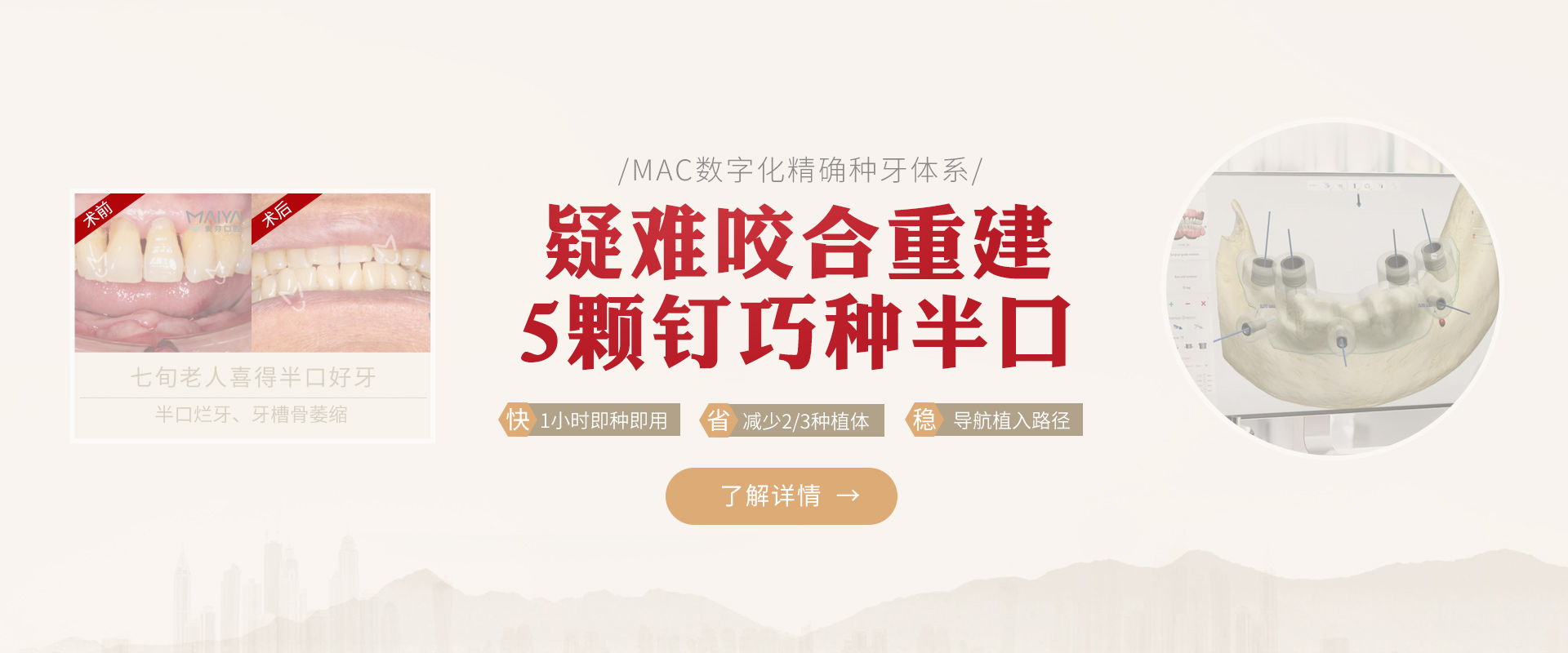 老李